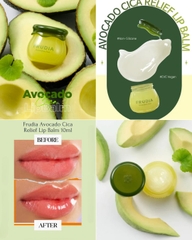 Dưỡng Môi Frudia Lip Balm 10ml