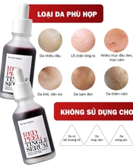 Tinh Chất Tái Tạo Da So.Natural Red Peel Tingle Serum
