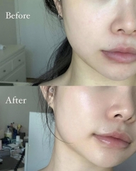 Thiết Bị Làm Đẹp Da Medicube Age-R Booster Pro