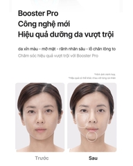 Thiết Bị Làm Đẹp Da Medicube Age-R Booster Pro