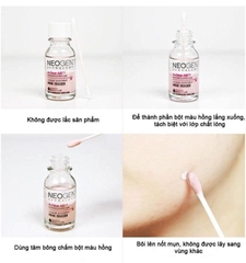Chấm Mụn 2 Lớp Neogen A-Clear Soothing Pink Eraser 15ml