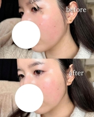 Tinh Chất CNP Laboratory Propolis Rescue Ampule 50ml