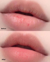 Dưỡng Môi Belif Super Knights Multi Vitamin Lipcerin 15ml