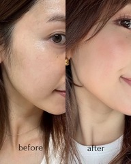 Che Khuyết Điểm About Tone Skin Layer Cover Concealer 5.6g
