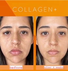 Thực Phẩm Bổ Sung Collagen Nội Sinh Menard Collagen Gold (10×30ml)