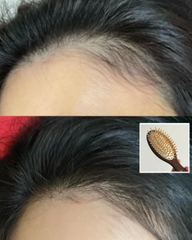 Bộ Gội Xả L'Oreal Paris 400ml