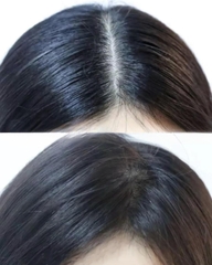 Bộ Gội Xả L'Oreal Paris 400ml