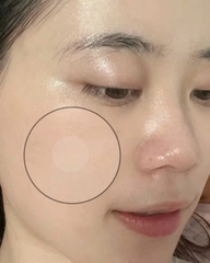 Miếng Dán Mụn Ngày Đêm Derma Angel Acne Patch