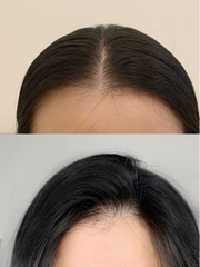 Bộ Gội Xả Muối Biển Spes Sea Salt Hyaluronic Acid Hydrating 600ml