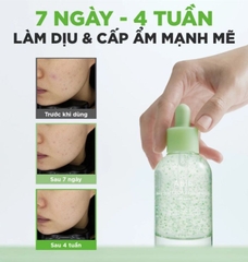 Tinh Chất Làm Dịu Da Abib Heartleaf Teca Capsule Calming Drop 50ml