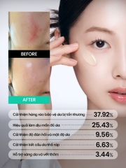 Tinh Chất Beplain Cica PDRN Skin Booster Serum 30ml