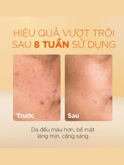 Tinh Chất Oh!Oh! Daily Nia23 Advanced Correcting Serum 50ml