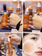 Tinh Chất Oh!Oh! Daily Nia23 Advanced Correcting Serum 50ml