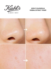 Bộ Đôi Hoa Cúc Làm Sạch Và Làm Dịu Da Kiehl’s Calendula Toner 250ml + Foaming Face Wash 230ml