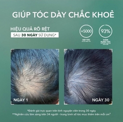 Tinh Chất Xịt Mọc Tóc, Dưỡng Tóc Khoẻ Yves Rocher Anti-Hair Loss Densifying Booster 195ml