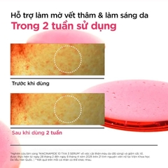 Tinh Chất Mờ Thâm, Dưỡng Sáng Anua Niacinamide 10% + TXA 3% Serum 30ml