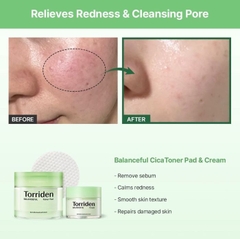 Kem Dưỡng Torriden Balanceful Centella Asiatica Extract Cream 80ml
