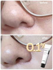 Kem Cải Thiện Nếp Nhăn Cosrx The Retinol Cream 0.1 20ml