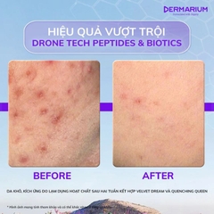 Tinh Chất Cấp Ẩm Tăng Cường Dermarium Quenching Queen