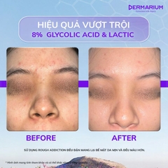 Tẩy Da Chết Hoá Học Làm Sạch Dermarium Rough Addiction