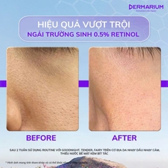 Tẩy Da Chết Hoá Học Dermarium Tender Wonder 8% Lactic Acid
