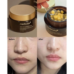 Kem Dưỡng Viên Nang Dưỡng Sáng Medicube Deep Vita Capsule Cream 55g