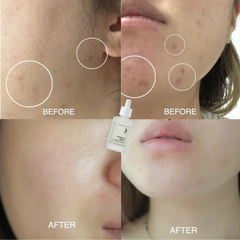 Tinh Chất Dưỡng Ẩm Mềm Mịn Numbuzin No.3 Skin Softening Serum 50ml