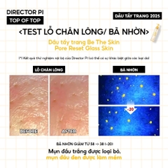 Dầu Tẩy Trang Be The Skin Pore Reset Glass Skin Cleansing Oil 150ml