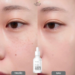Tinh Chất So.Natural Red Peel White Serum