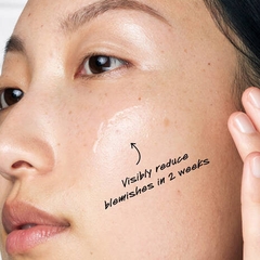 Tinh Chất Kiềm Dầu Kiehl's Ultra Pure Serum 5% Niacinamide 30ml