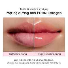 Mặt Nạ Môi Dạng Thạch Abib PDRN Collagen Lip Mask 11g