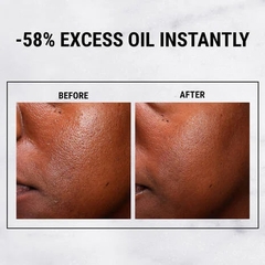 Tinh Chất Kiềm Dầu Kiehl's Ultra Pure Serum 5% Niacinamide 30ml