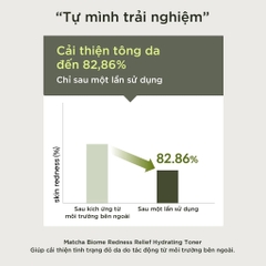 Nước hoa hồng Heimish Matcha Biome Redness Relief Hydrating Toner 150ml