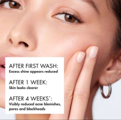 Sữa Rửa Mặt Vichy Normaderm Phytosolution Purifying Cleansing Gel 200ml (NK)