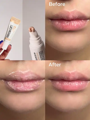 Dưỡng Môi Mediheal Pantenolips 10ml