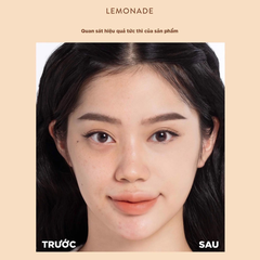 Che Khuyết Điểm Lemonade Matte Addict Concealer