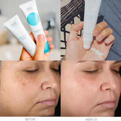 Kem Dưỡng Obagi Retinol 1.0 Cream