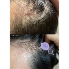 Lược Gội Đầu Wet Brush Go Green Scalp First Exfoliator