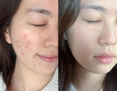Kem Dưỡng Bioderma Sebium Sensitive 30ml