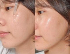 Tinh Chất Beplain Multi Hyaluronic Acid Ampoule 30ml