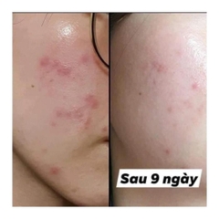 Gel Rửa Mặt Biotrade Acnaut Oxy Wash Cleansing Gel 200ml