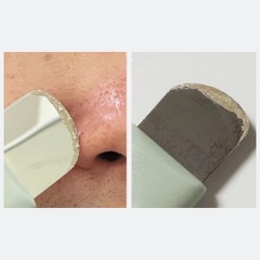 Dung Cụ Làm Sạch Da Ilso Deep Clean Master