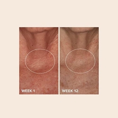 Kem Dưỡng Thể Paula's Choice Phytoestrogen Elasticity Renewal Body Treatment 100ml