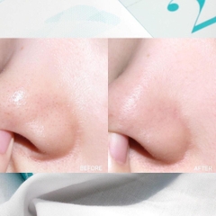 Dung Cụ Làm Sạch Da Ilso Deep Clean Master