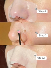 Bộ Loại Bỏ Bã Nhờn, Mụn Đầu Đen Ilso Natural Mild Clear Nose Pack (5 pcs)
