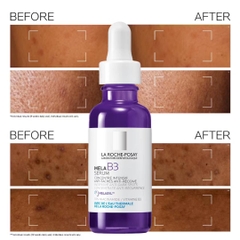 Tinh Chất La Roche-Posay Mela B3 Serum 30ml