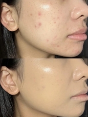 Kem Nền Haus Labs Triclone Skin Tech Foundation 30ml