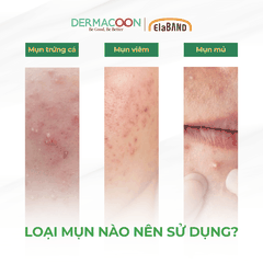 Hộp miếng dán mụn che khuyết điểm và giảm mụn Elaband Hydro Dot Tea Tree ( 3 gói )