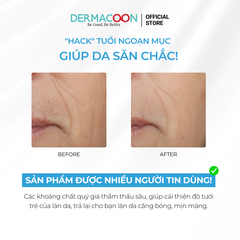 Mặt nạ dưỡng ẩm giúp da mềm mịn căng bóng và tràn đầy sức sống PAXMOLY Super Aqua Mask Pack 5 Miếng