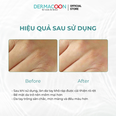 PAXMOLY Vitamin Collagen Hand & Nail Repair Cream 100ml Kem dưỡng ẩm cho da tay và móng tay 100ml